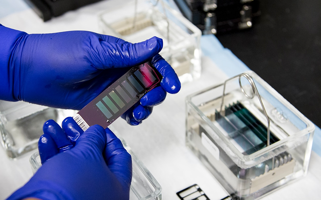 How do at-home blood tests work