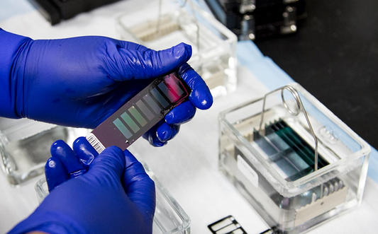How do at-home blood tests work